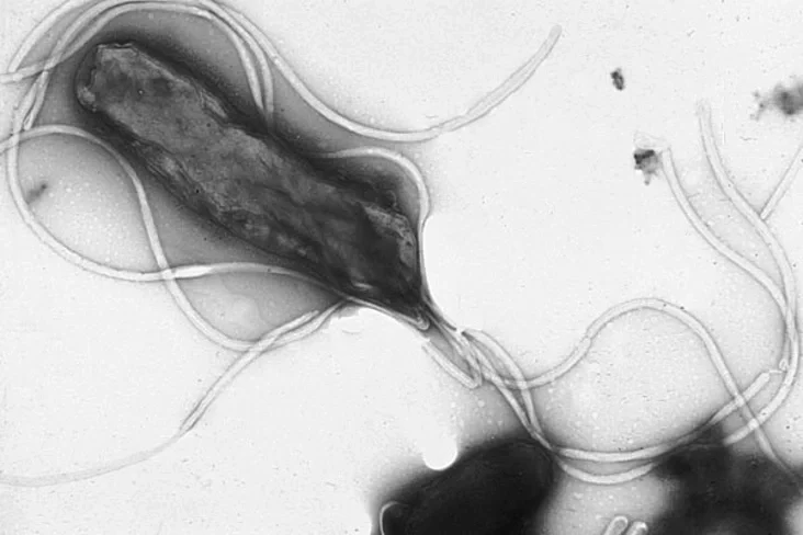 Helicobacter pylori 